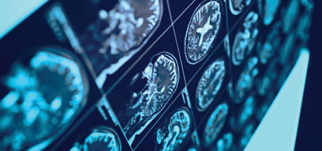 Radiology claims image